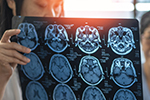 The Role of MRI in Monitoring Brain Health: Preventing Cognitive Decline